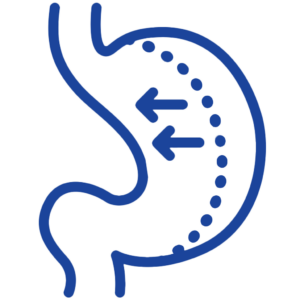 Short-Term Weight Loss vs. Long-Term Maintenance
