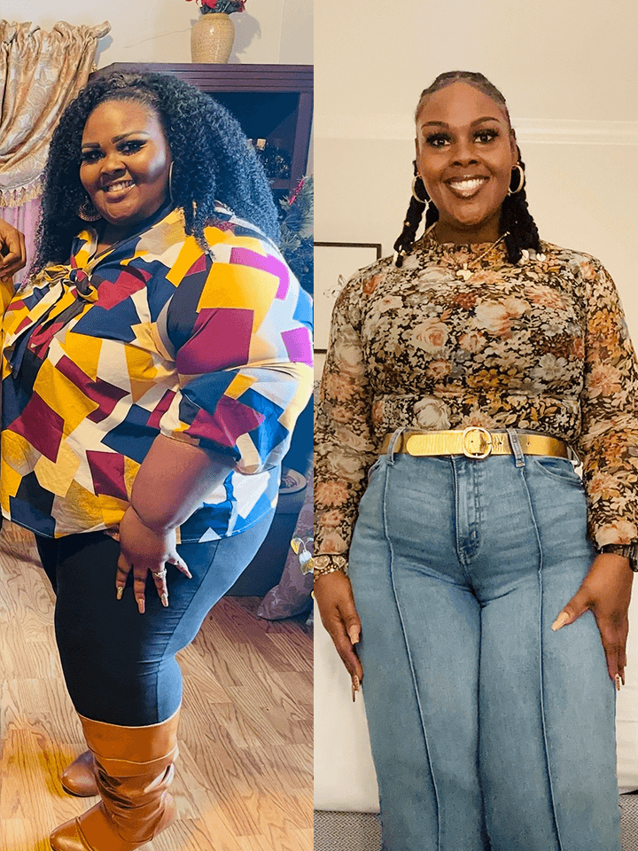 Side by side view of a before and after photo of a dramatic weight loss.